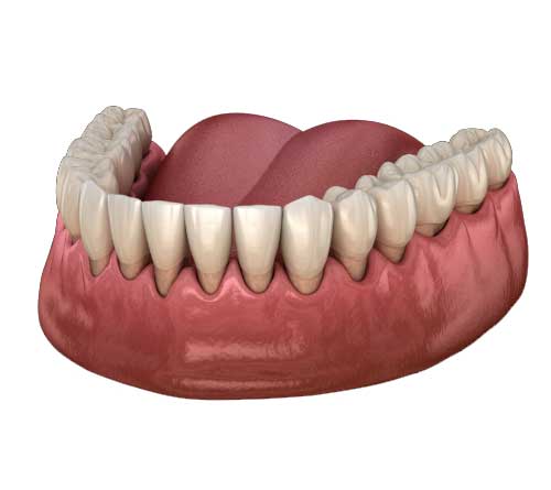 gum recession for gum grafting